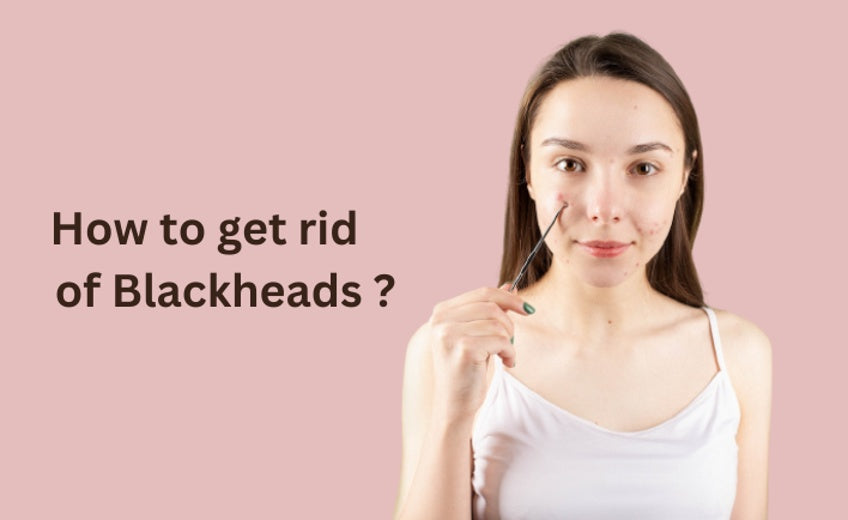 Blackheads