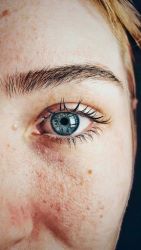 How to Get Rid of Red, Irritated Skin