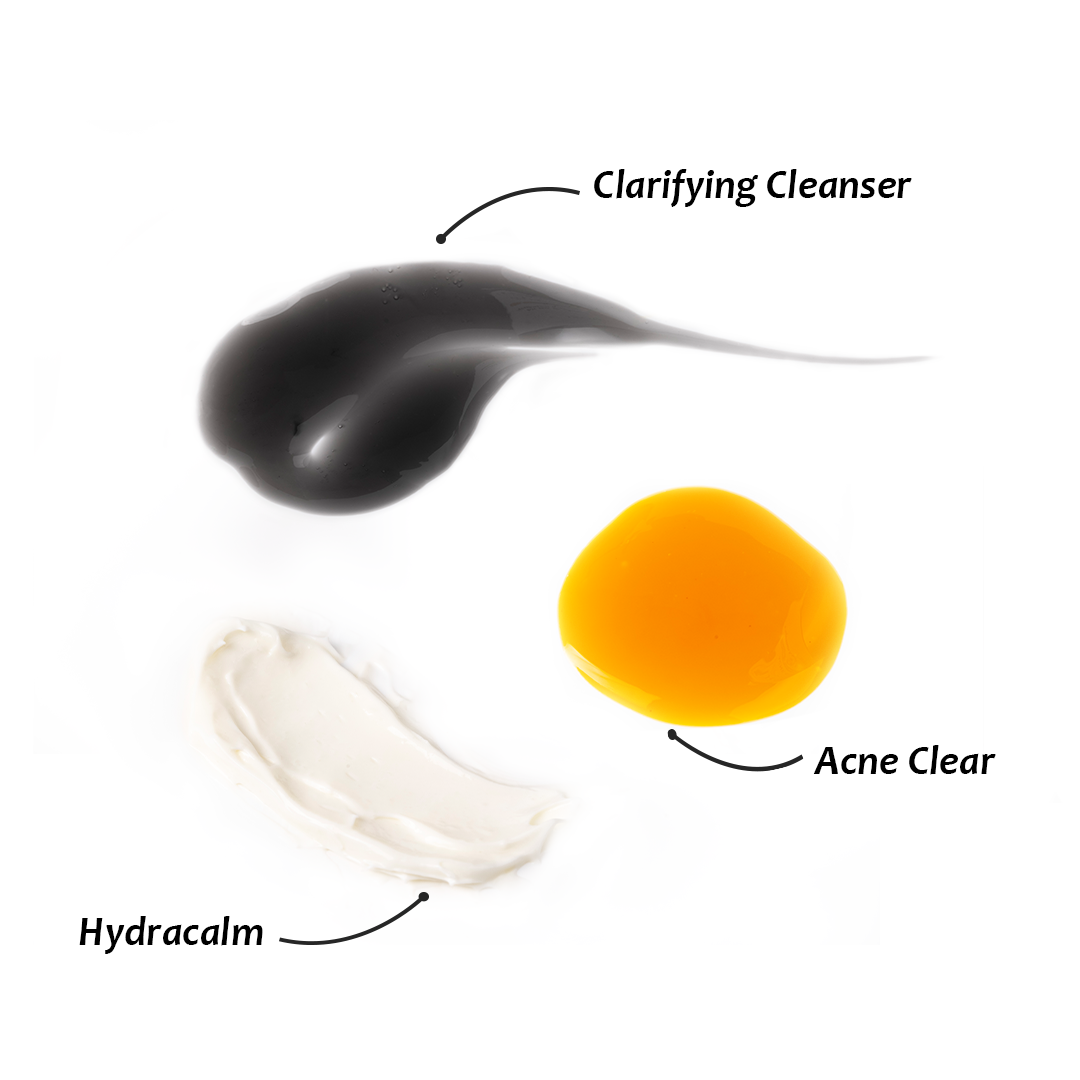 Textures of Clarifying Cleanser, Acne Clear Serum, and Hydracalm Moisturiser