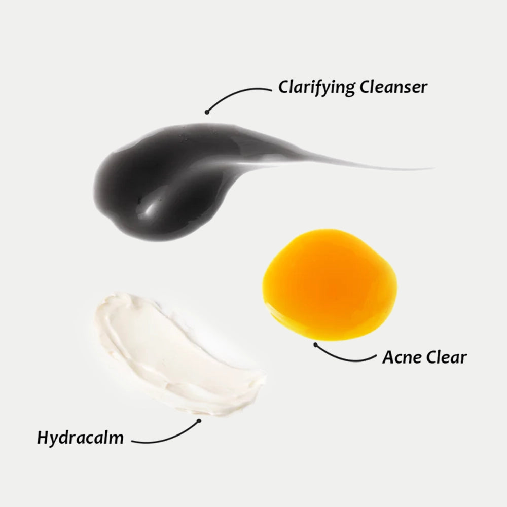 Acne Starter Kit