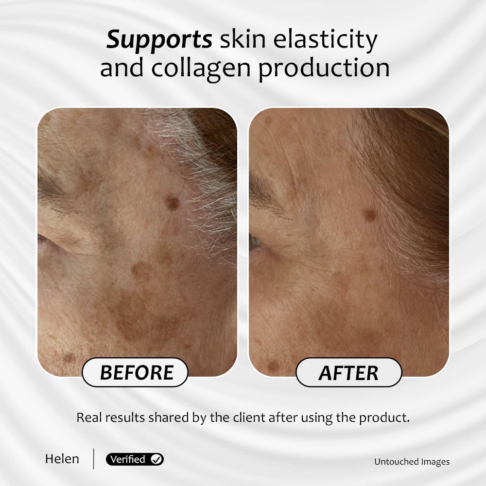 Client's before-and-after photos showing visible improvement in dark spots after 4 weeks.