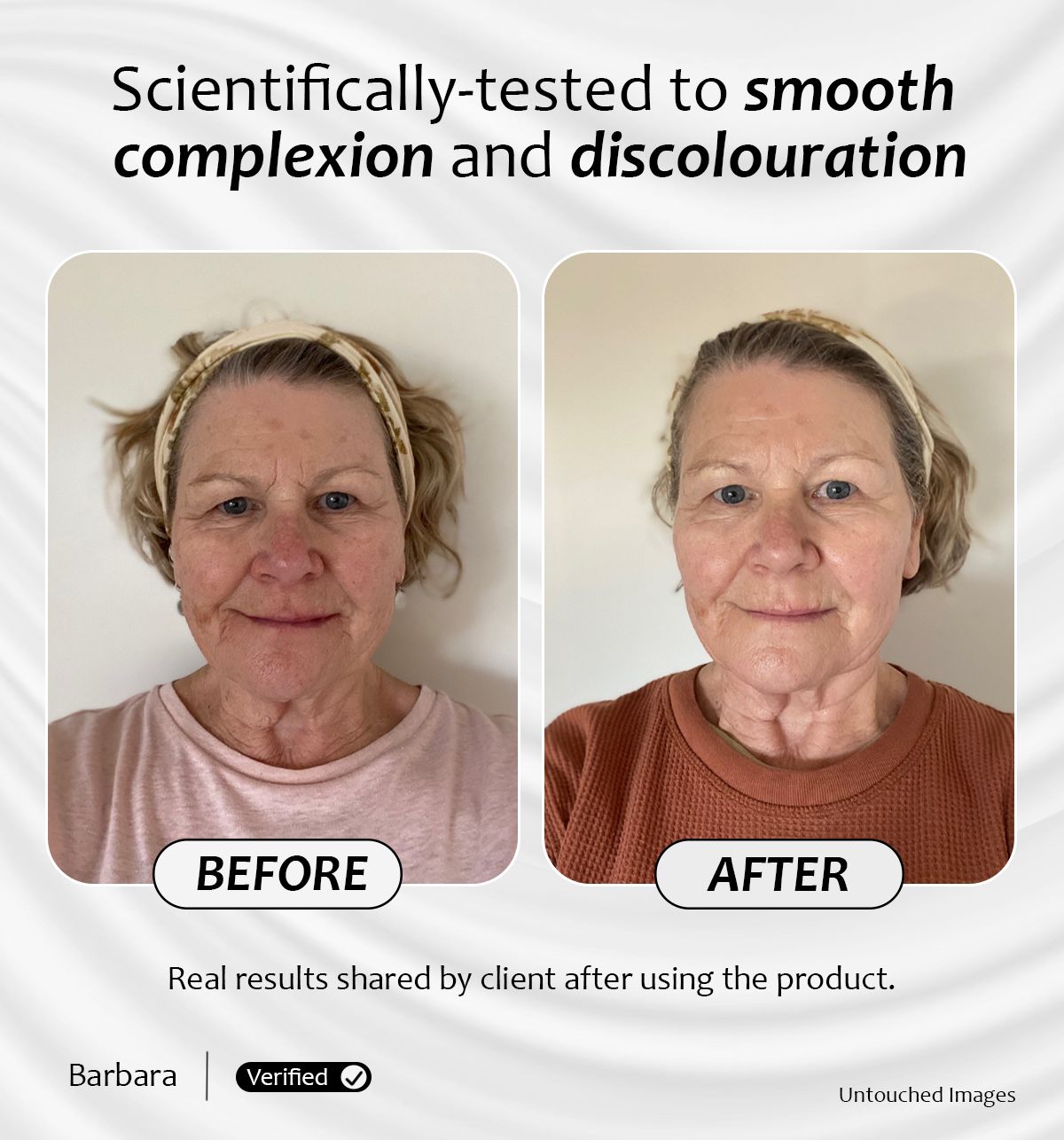 Before and after results of Skin Bright Serum showing smoother complexion and reduced skin discolouration