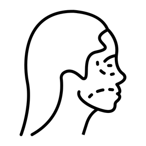 Skin with premature ageing signs