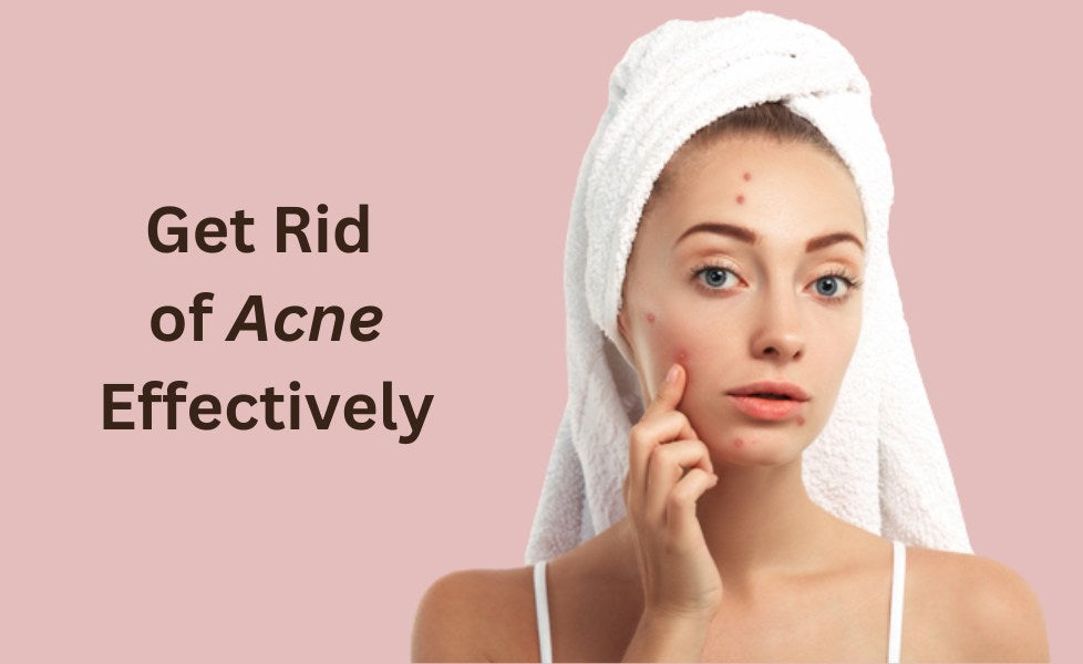 Get Rid of Acne Effectively