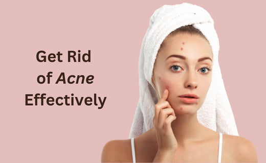 Combat Acne Through The Effective Skincare Routine