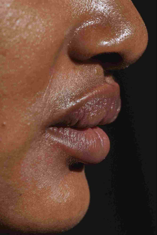 Sebum and Its Role in Acne Production