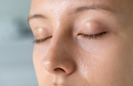 A woman with a greasy shine on her face due to excess sebum