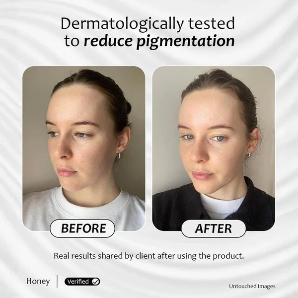 Before and after images of a client are shown after using DRSQ retinaldehyde serum 