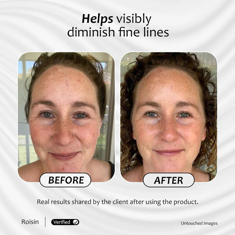Before and after images of a client after using Advanced Vitamin A serum