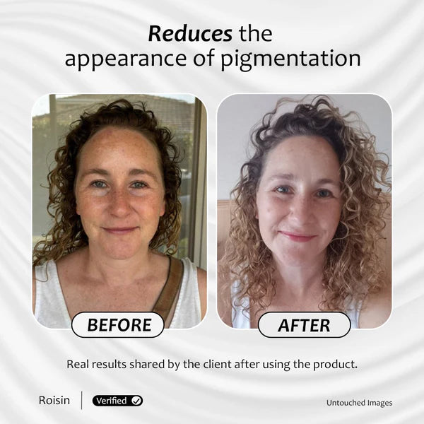 Client's before and after images are shown after using Vitamin A serum for months