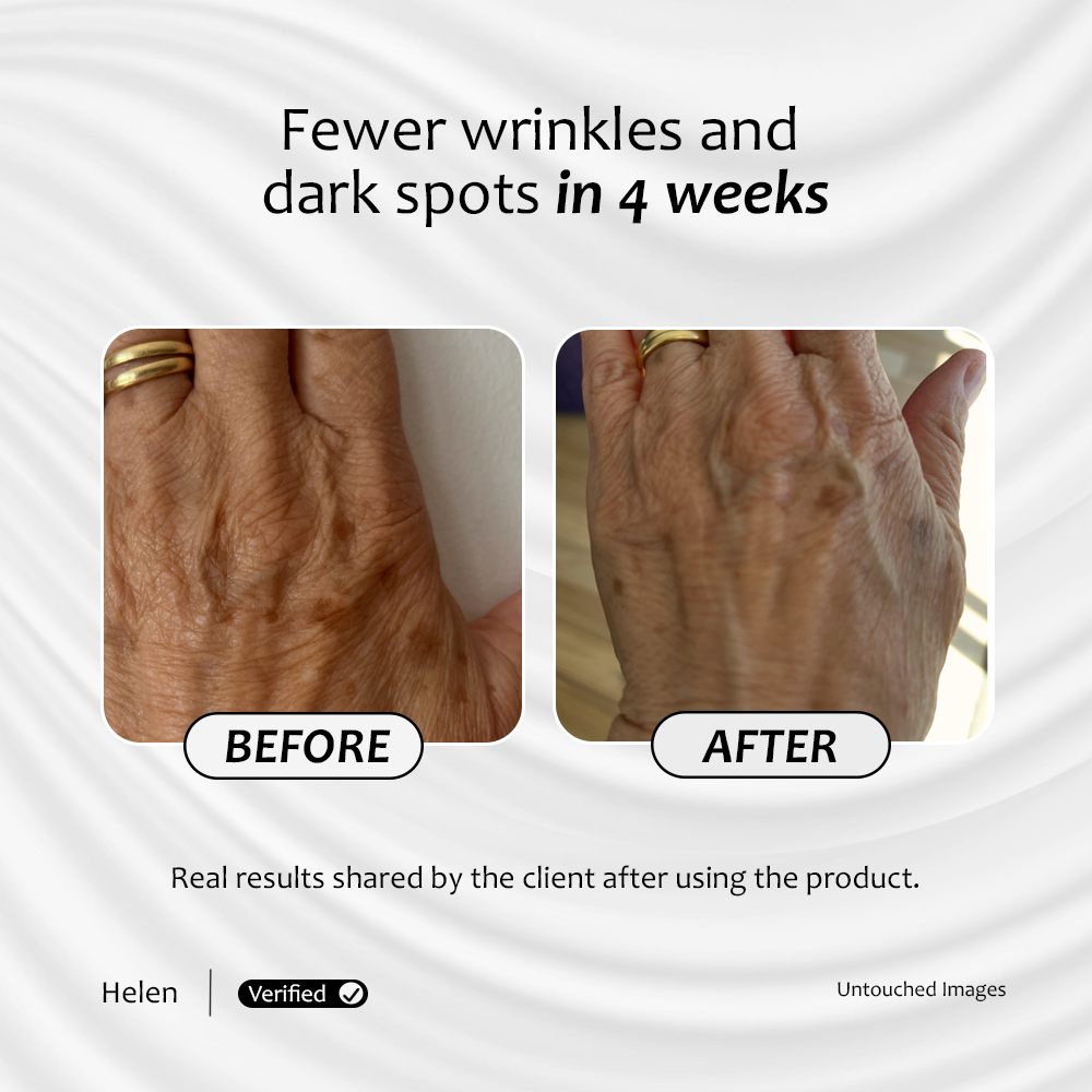 Client image showing fewer wrinkles after 4 weeks of using Skin Bright serum