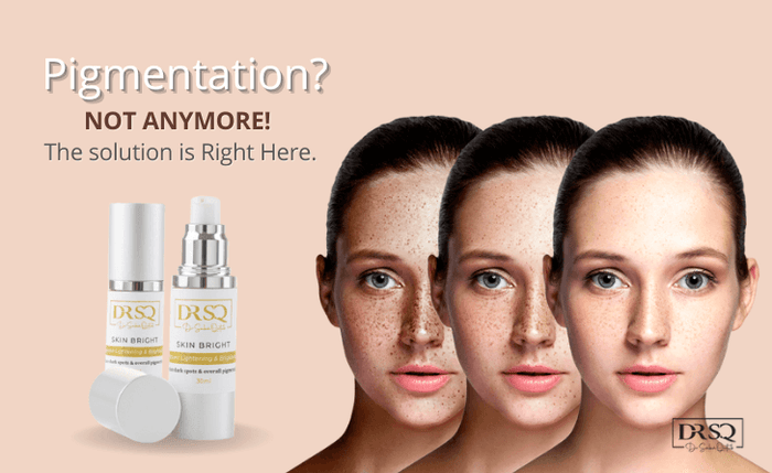 Pigmentation? Not Anymore! The solution is Right Here