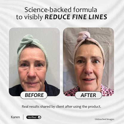 Before and after results of Renew & Glow Serum showing visibly reduced fine lines and smoother skin