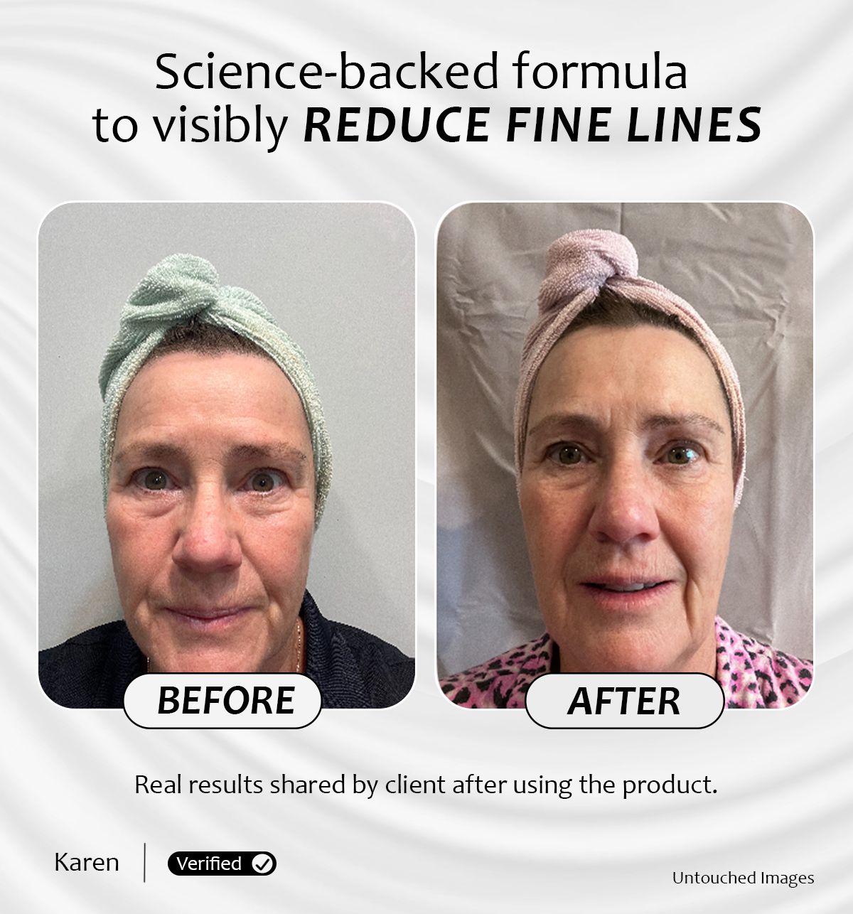 Before and after results of Renew & Glow Serum showing visibly reduced fine lines and smoother skin