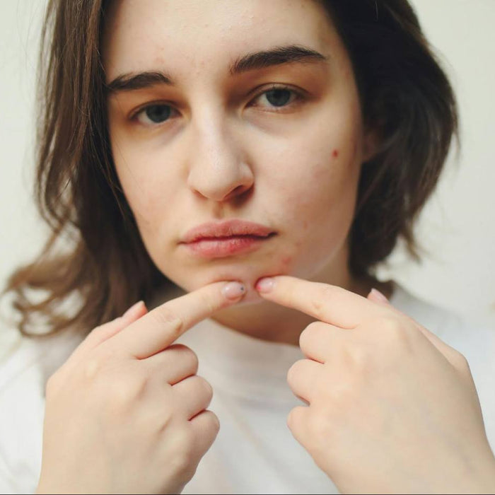 Skincare for Oily Skin: Routine & Maintenance Tips
